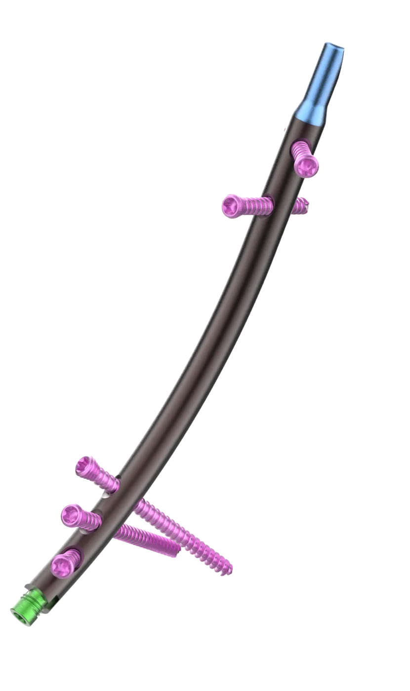 Retro Distal Tibia Nail