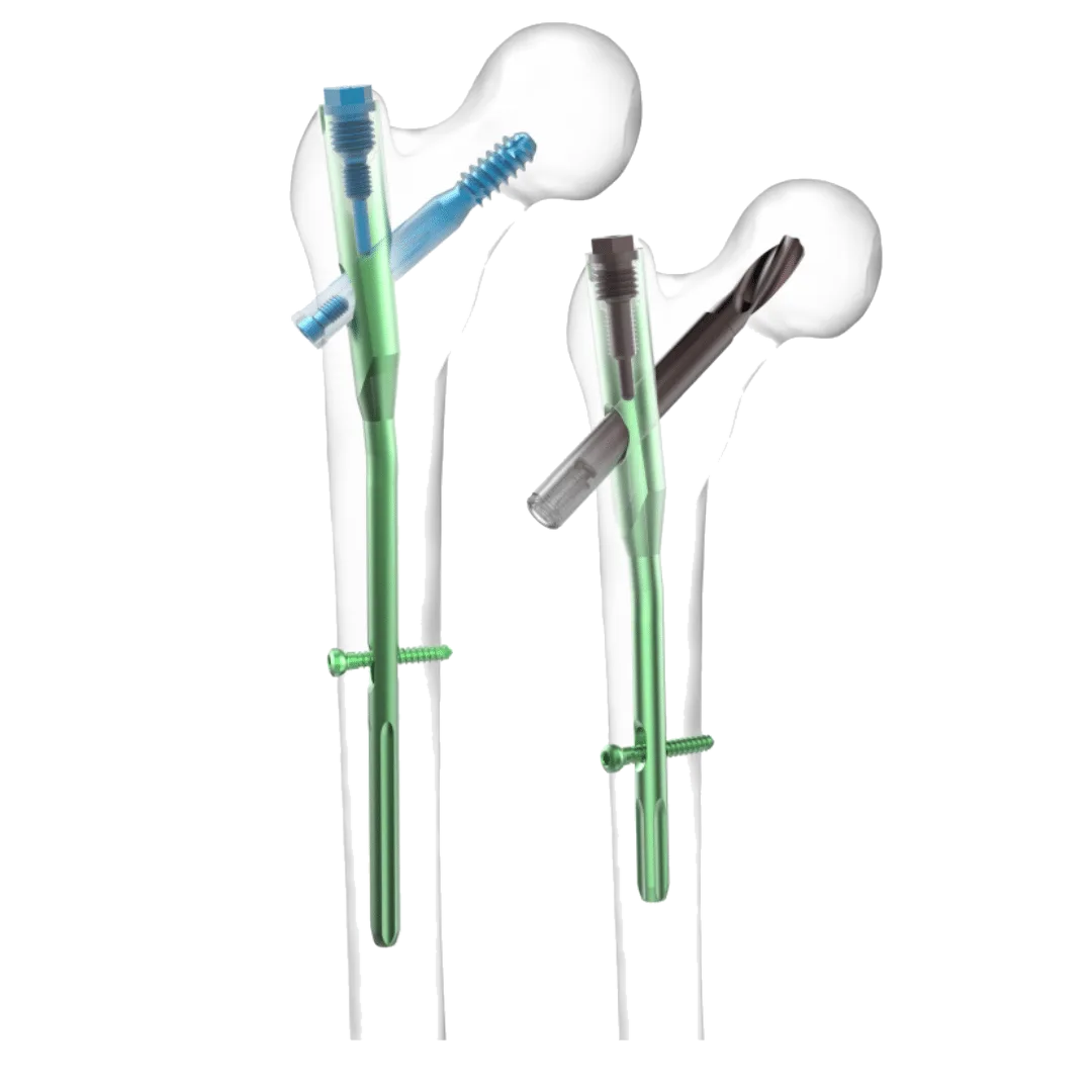 AJAX® Nailing System (Hip/Femur)