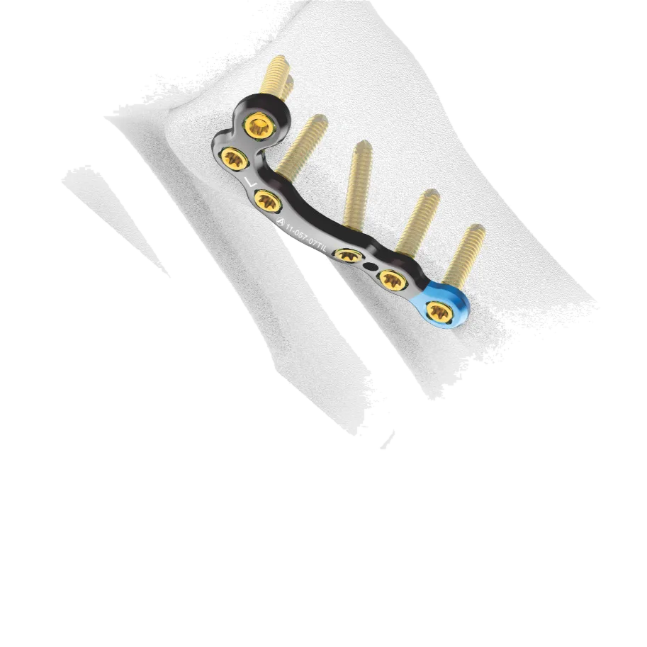 TMT Plantar Fusion Plate
